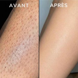 KyraGlow — Enfin une peau lisse sans repousses Kyrasanté