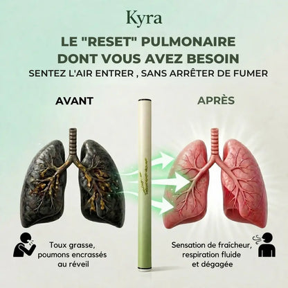 Kyralife - Commencez votre cure de réparation pulmonaire Kyra