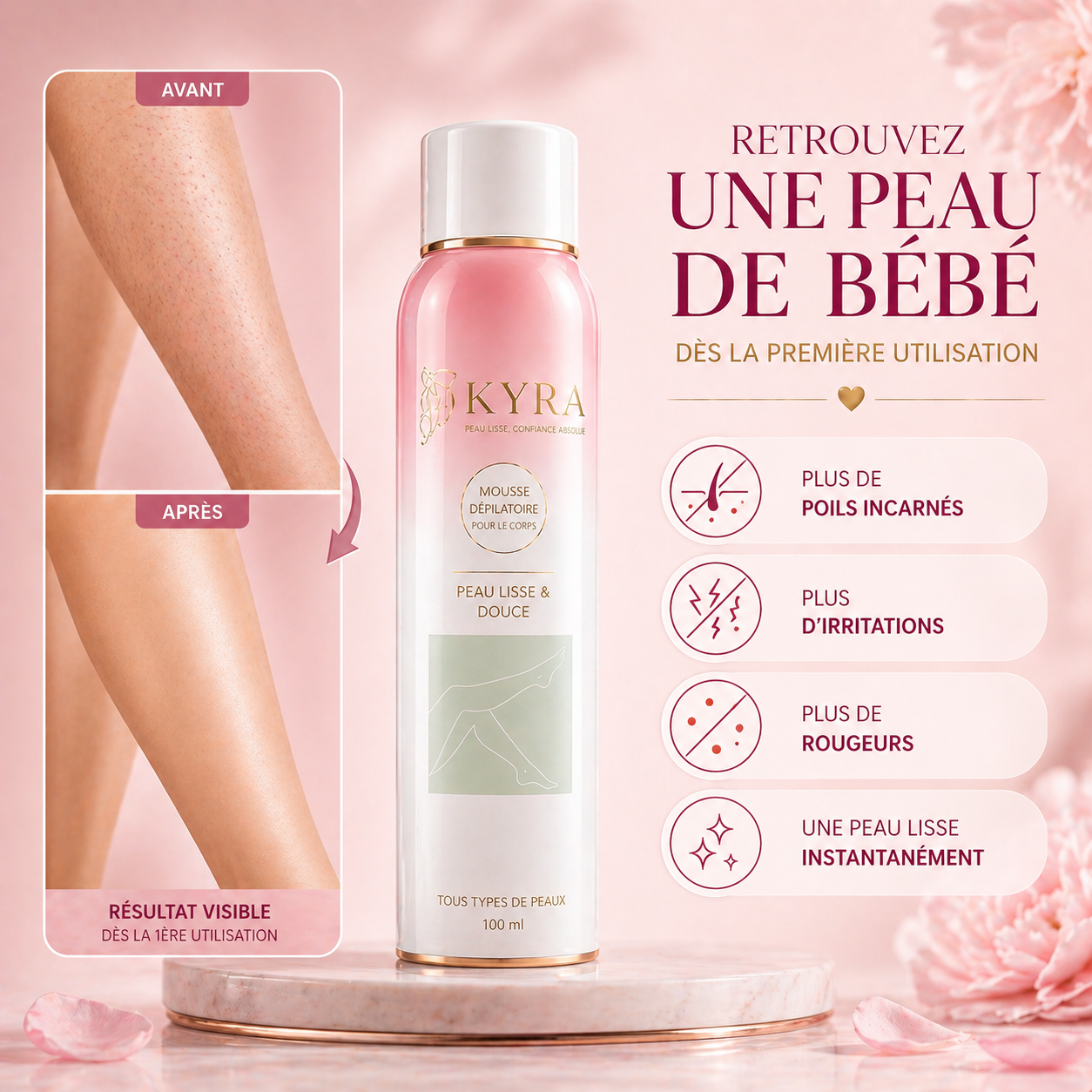 Kyra Smooth™ – Une peau lisse comme vous ne l'avez jamais connue, sans repousse rapide Kyrasanté