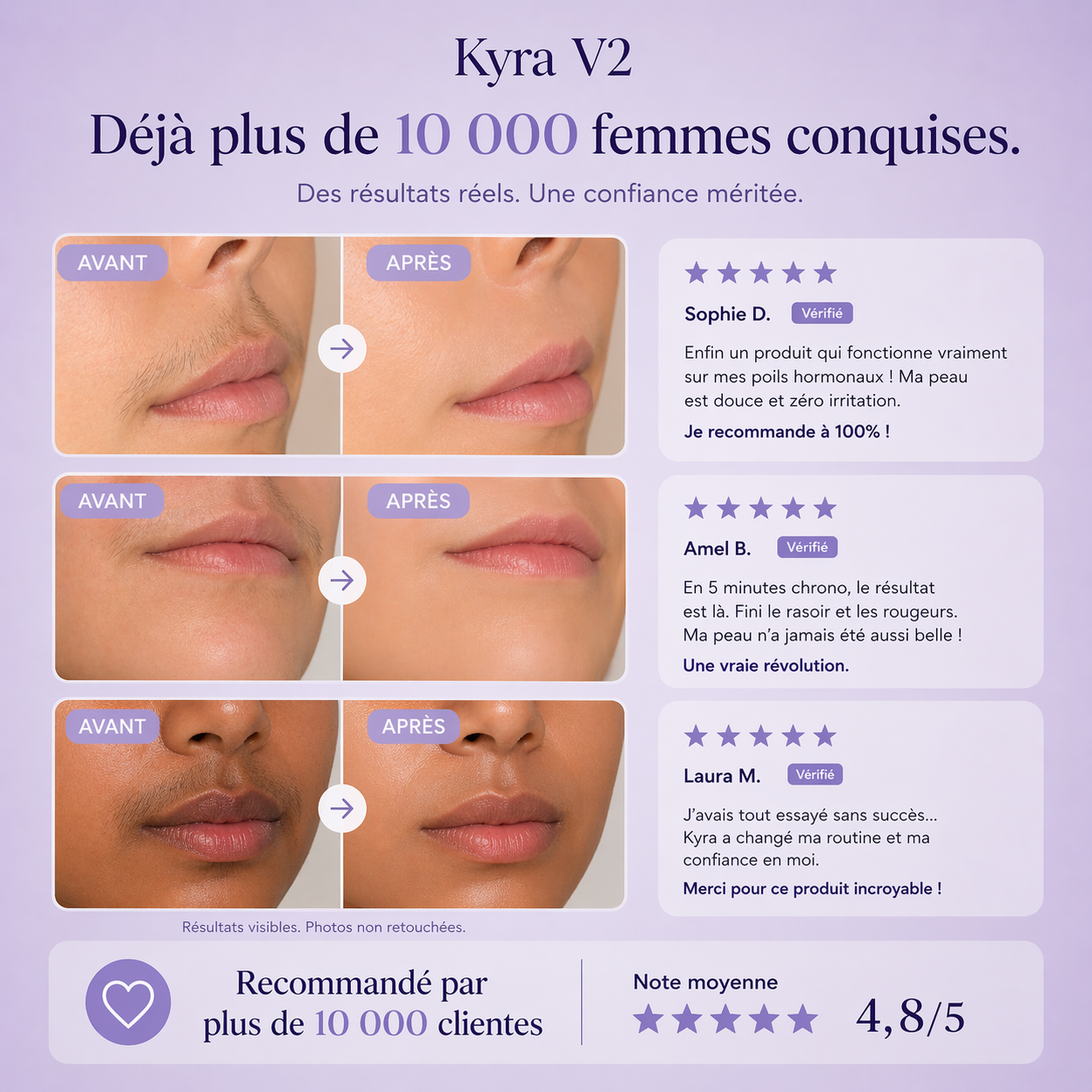 Crème anti repousse V2 - Kyrasanté